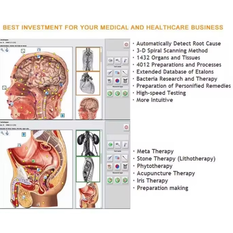 Metatron Hunter 4025 NLS Biore - Holistic Health & Wellness 评论和价格